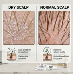 RootRise™ Digital Scalp Analyzer - Image 4