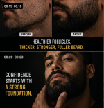 RootRise™ Beard Elixir - Image 4