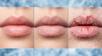 RootRise™ Mint Revive Lip Therapy - Image 4